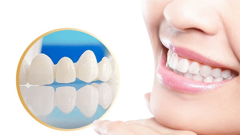 Răng sứ Zirconia với màu sắc trắng đẹp tự nhiên như răng thật