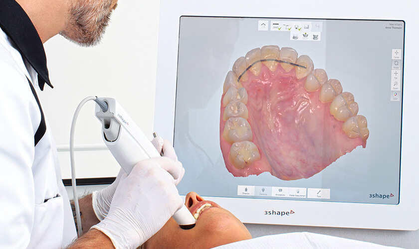 Công nghệ lấy dấu răng 3D hiện đại