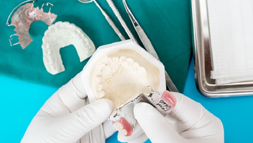 Quy trình làm răng sứ tháo lắp rất an toàn và nhanh chóng