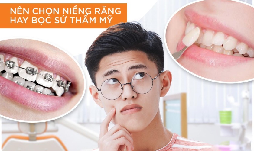 Nên niềng răng hay bọc răng sứ cho 2 răng cửa to và hô?