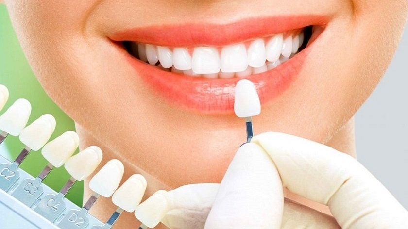 Bọc răng sứ Cercon giúp bạn có nụ cười thật xinh Bọc răng sứ Cercon giúp bạn có nụ cười thật xinh