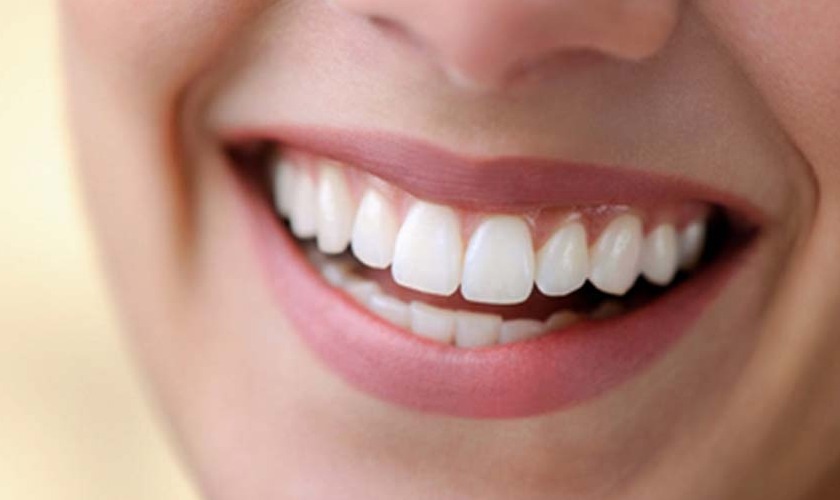 Bọc răng sứ có đau không? Chú ý gì sau khi bọc răng sứ?