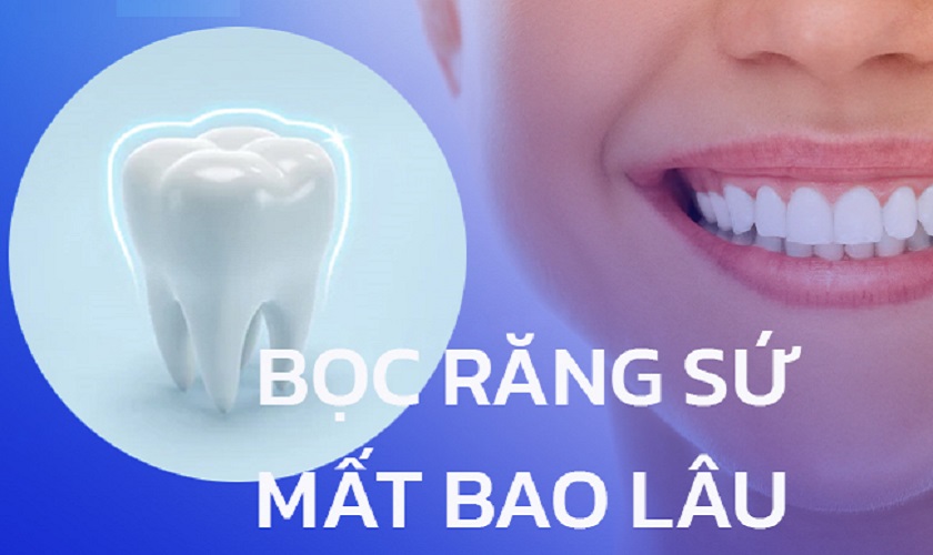 Thời Gian Bọc Lại Răng Sứ