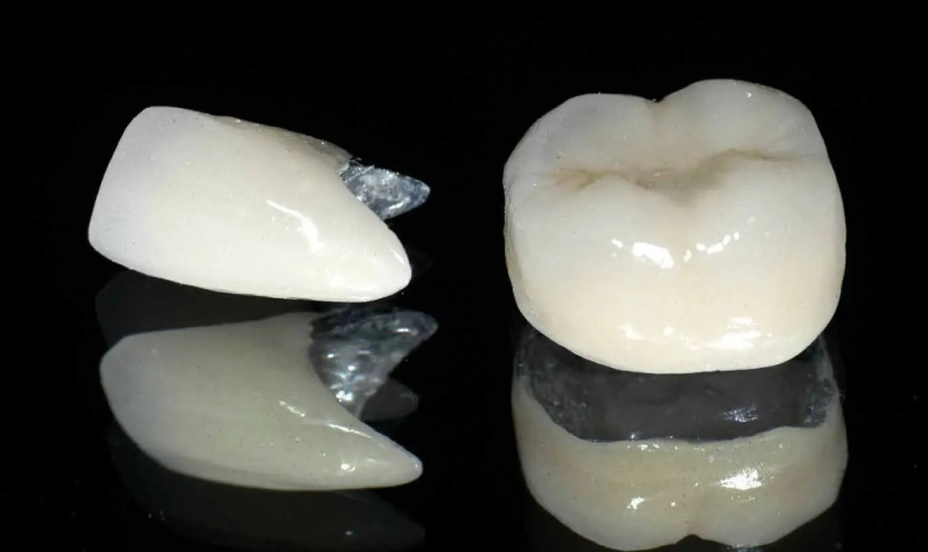 Răng sứ Mỹ thực chất là răng sứ kim loại