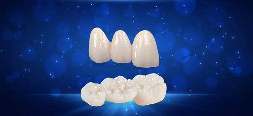 Nha khoa tốt cần đảm bảo được chất lượng răng sứ sử dụng