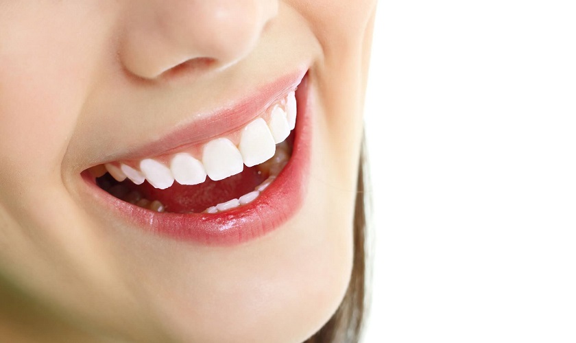 Cách làm răng sứ chuẩn quốc tế bao gồm bao nhiêu bước?