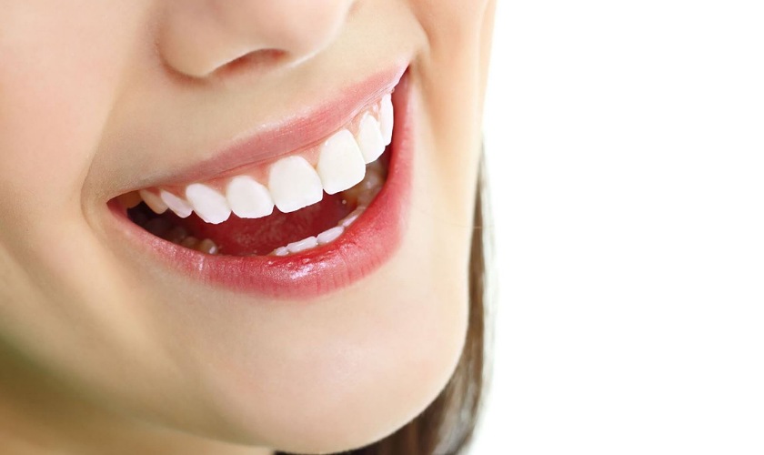 Răng sứ Cercon có màu sắc tương đồng với răng thật