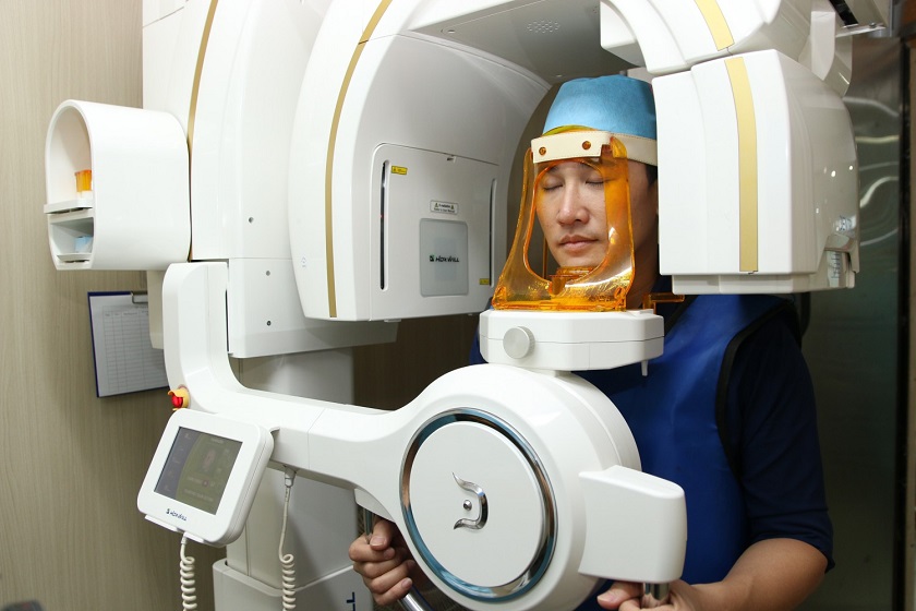 Chụp phim X-quang CT Cone Beam 3D