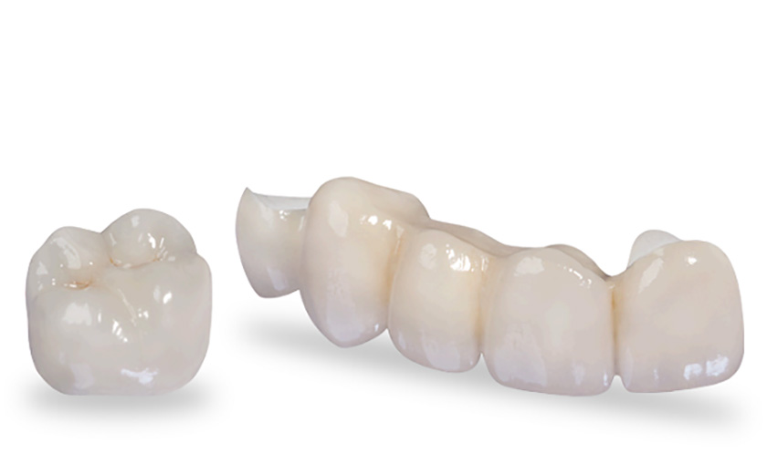 Răng sứ Zirconia có tốt không thường gặp của nhiều khách hàng khi lựa chọn dòng răng bọc răng sứ