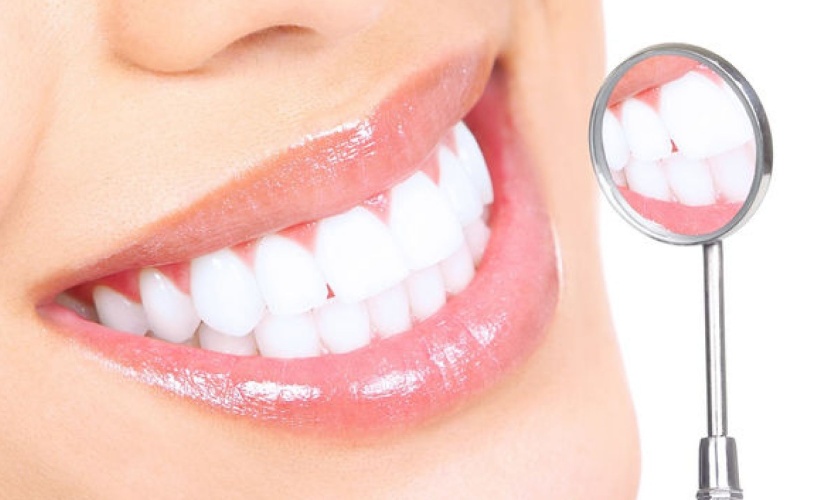 Răng sứ mang lại thẩm mỹ cao