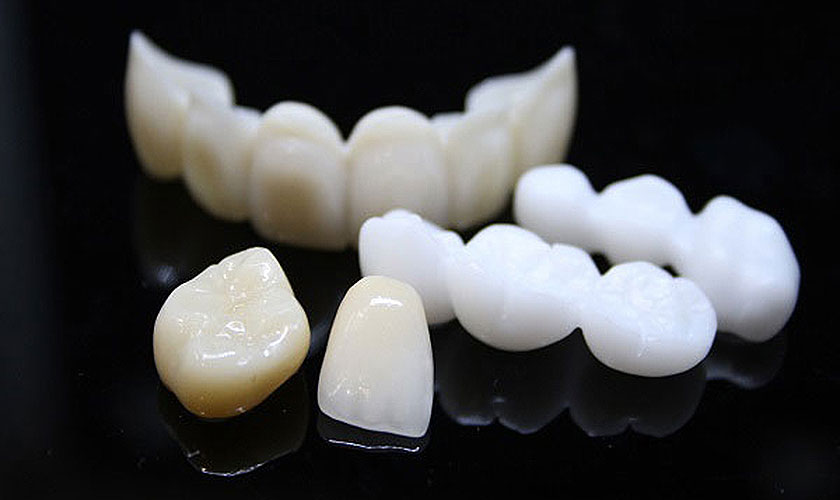 Giá răng sứ Zirconia nha khoa Nhân Tâm dao động từ 4.500.000 – 6.000.000 đồng / răng