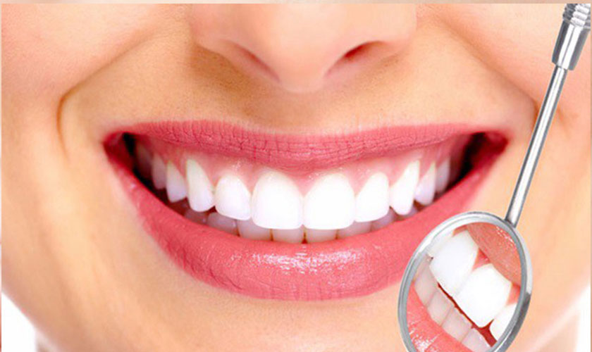 Trồng răng sứ titan có tuổi thọ của răng titan từ 10 – 15 năm