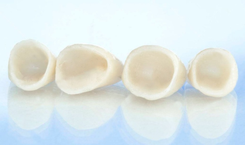 Răng toàn sứ có độ thẩm mỹ cao và đảm bảo chức năng nhai như răng thật