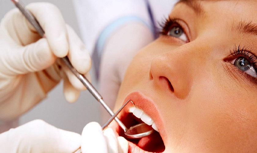 Viêm lợi sau khi bọc sứ do quy trình bọc sứ nhiều sai sót