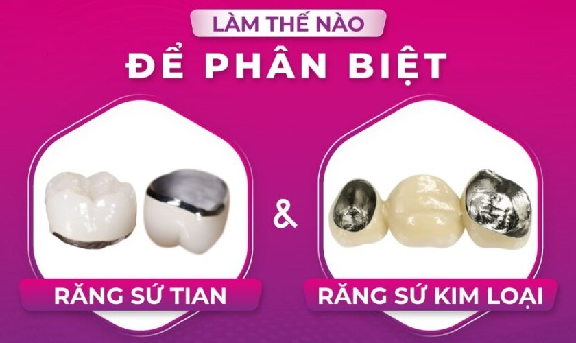 Nếu bạn phân vân chọn răng sứ thường hay răng sứ Titan, nha khoa Nhân Tâm xin tư vấn nên chọn răng sứ titan