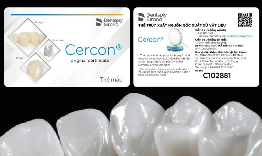 Giá làm răng sứ Cercon được rất nhiều người quan tâm