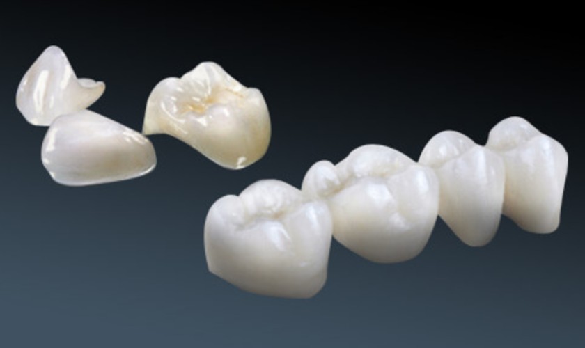 Răng sứ Cercon HT