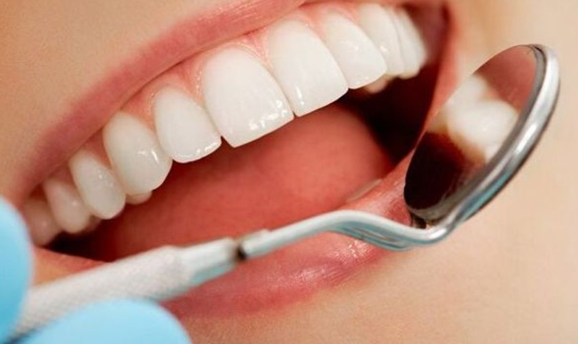 Bọc răng sứ Cercon HT có nhiều ưu điểm