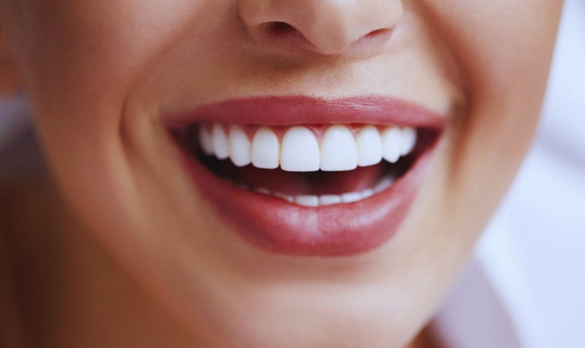 Bọc răng sứ tẩy trắng răng không hiệu quả