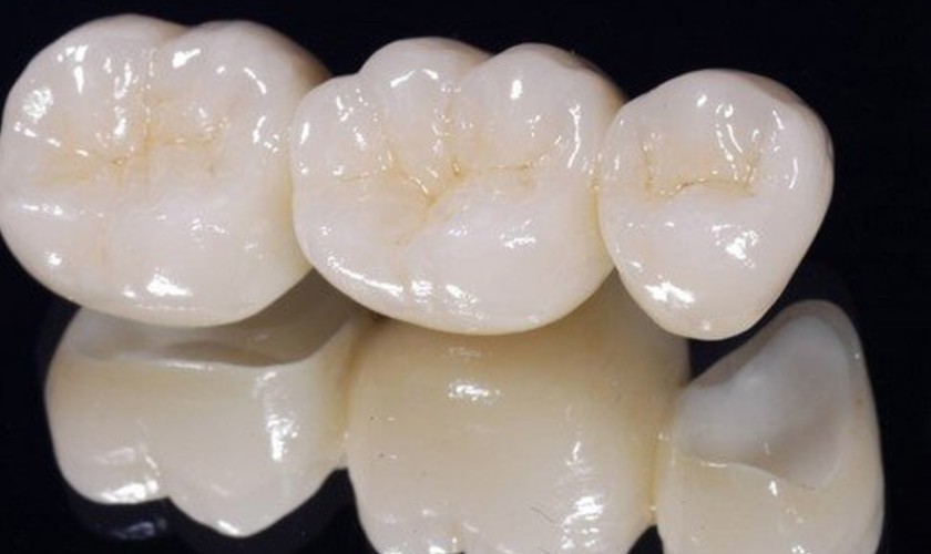 Làm răng Titan tại nha khoa Nhân Tâm Làm răng Titan tại nha khoa Nhân Tâm