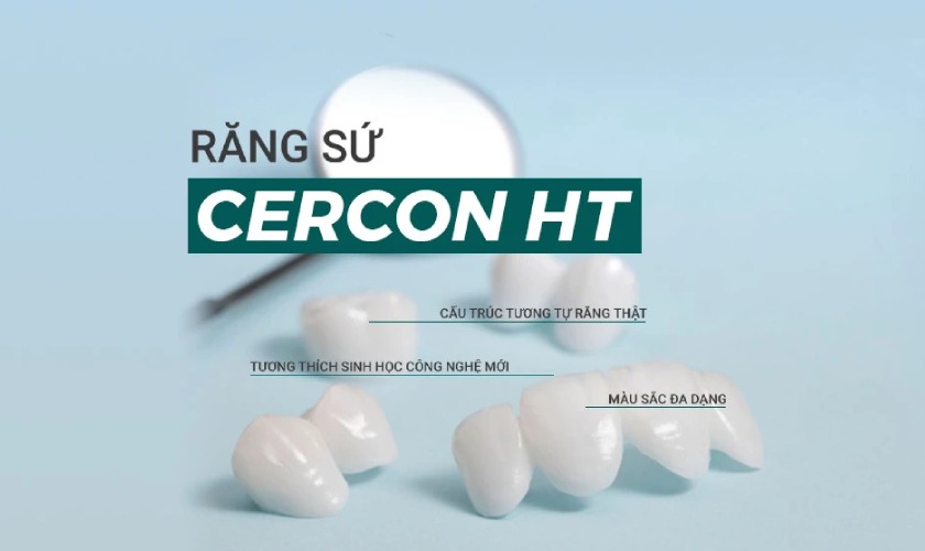 Răng sứ Cercon mang cho bạn một hàm răng đẹp Răng sứ Cercon mang cho bạn một hàm răng đẹp