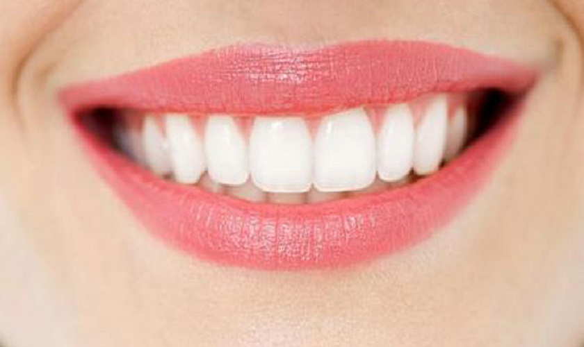 Răng sứ toàn sứ là gì? Đặc điểm ra sao? Chi phí thế nào?