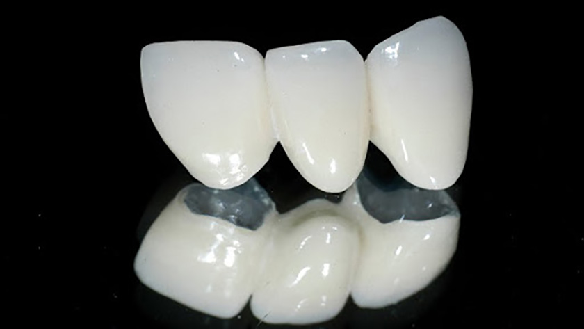Răng sứ Zirconia có tốt không là câu hỏi của nhiều khách hàng khi có rất nhiều dòng răng sứ đang được sử dụng hiện hành