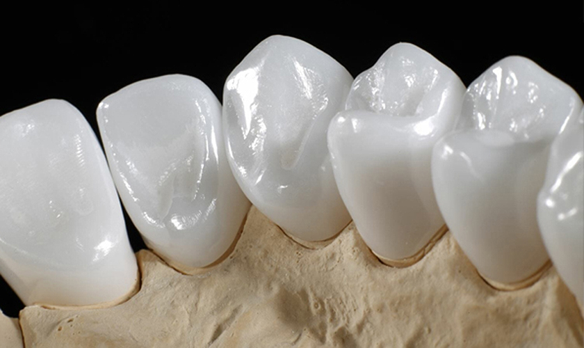 Răng sứ Zirconia được nhiều người đánh giá cao