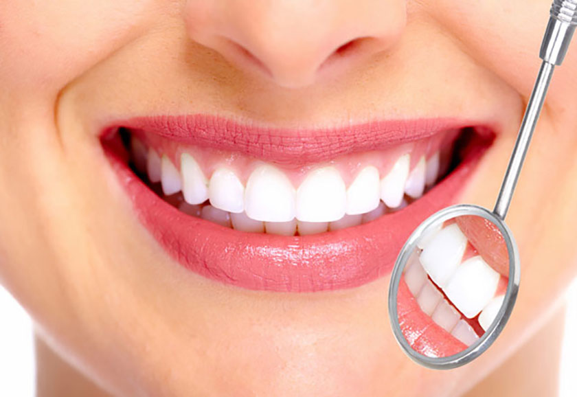 Răng sứ Zirconia có thể sử dụng đến 25 năm hoặc hơn