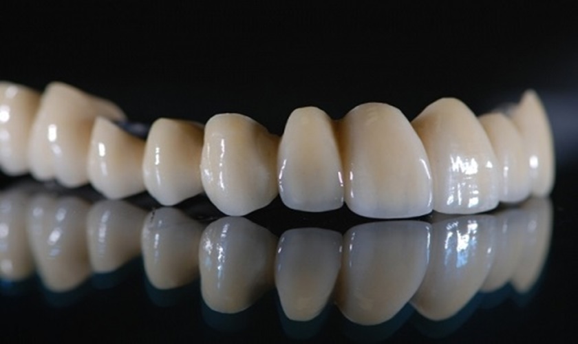 Thời gian làm răng sứ Titan được bao lâu? Có nên làm không?