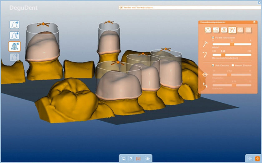 Hệ thống phần mềm xử lý hiện đại tại nha khoa Nhân Tâm