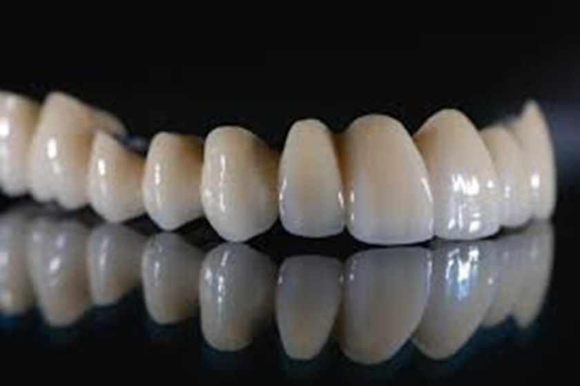 Giữ gìn đúng cách sẽ giữ răng sứ Titan đẹp và bền hơn