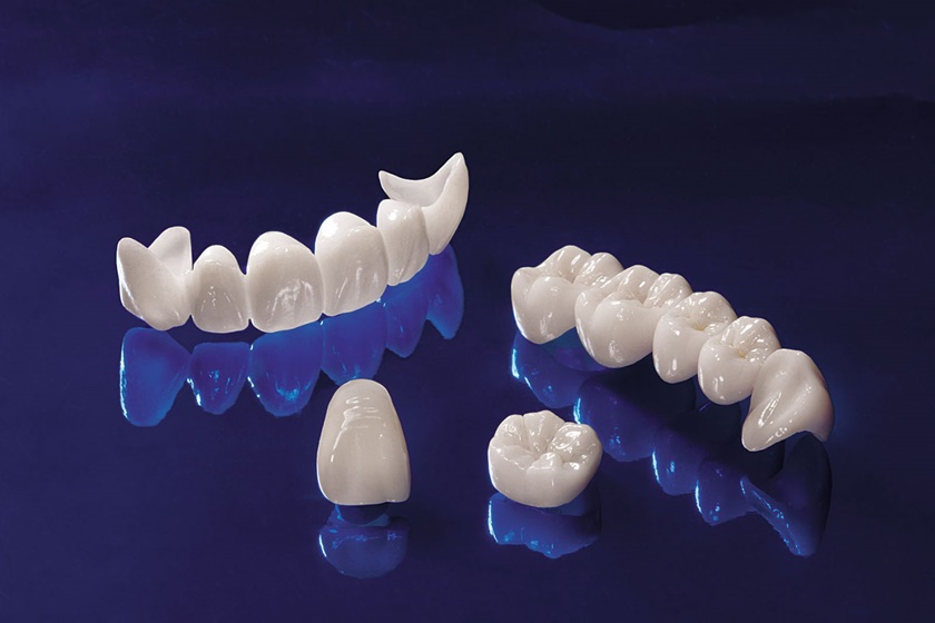 Loại răng sứ Cercon Zirconia