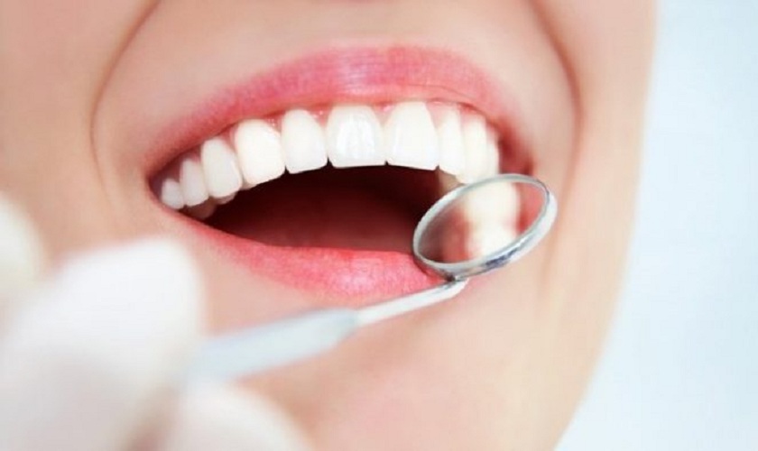 Răng sứ Cercon là gì? Những lợi ích của răng sứ Cercon?