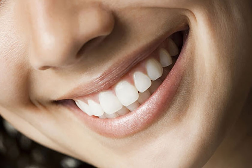 Quy trình làm toàn sứ răng Zirconia và Ceron cần đạt tiêu chuẩn để đảm bảo chất lượng tốt nhất