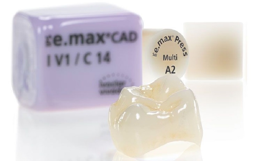 Răng sứ cao cấp Emax