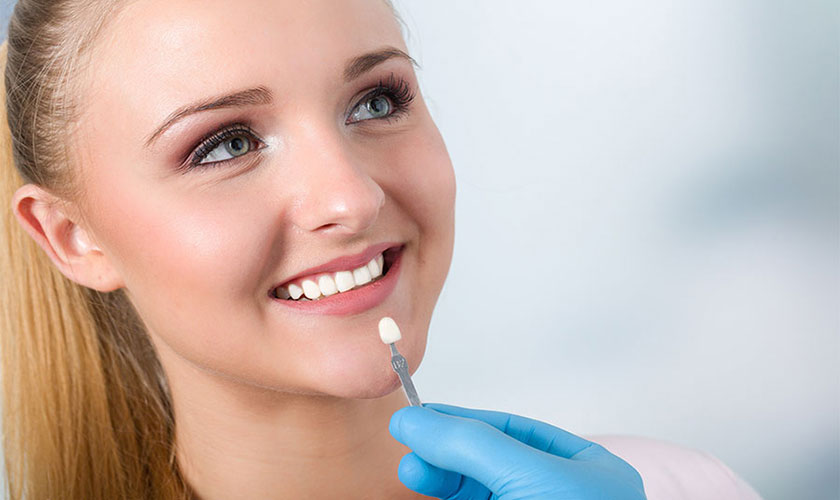 Giá cả răng sứ dao động từ 2.000.000 – 3.000.000 đồng / răng