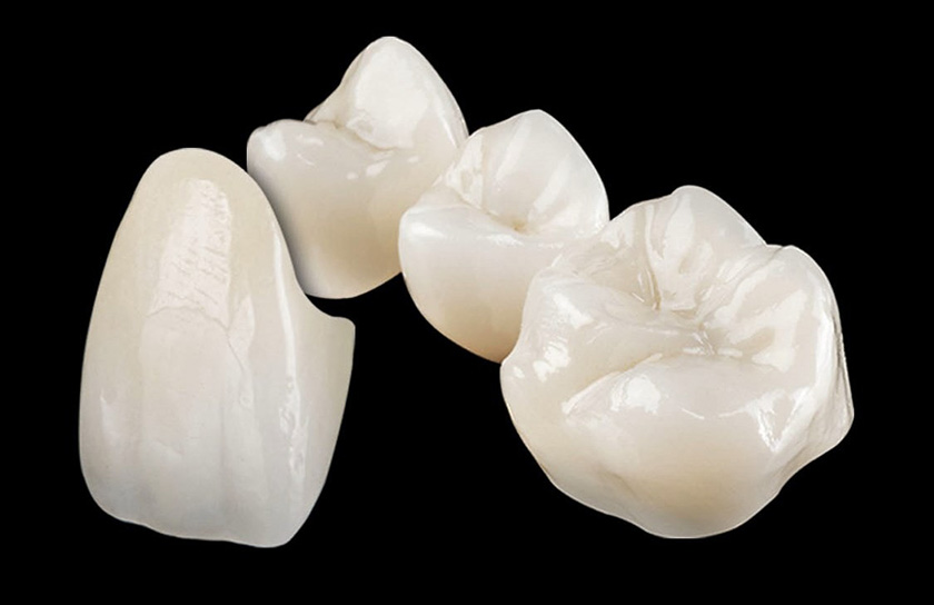 Giá răng sứ Zirconia nha khoa Nhân Tâm là câu hỏi của nhiều khách hàng
