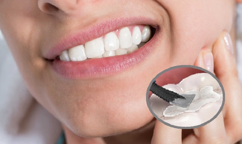 Những nguyên nhân nào có thể gây nên việc răng trám lâu ngày bị nhức?
