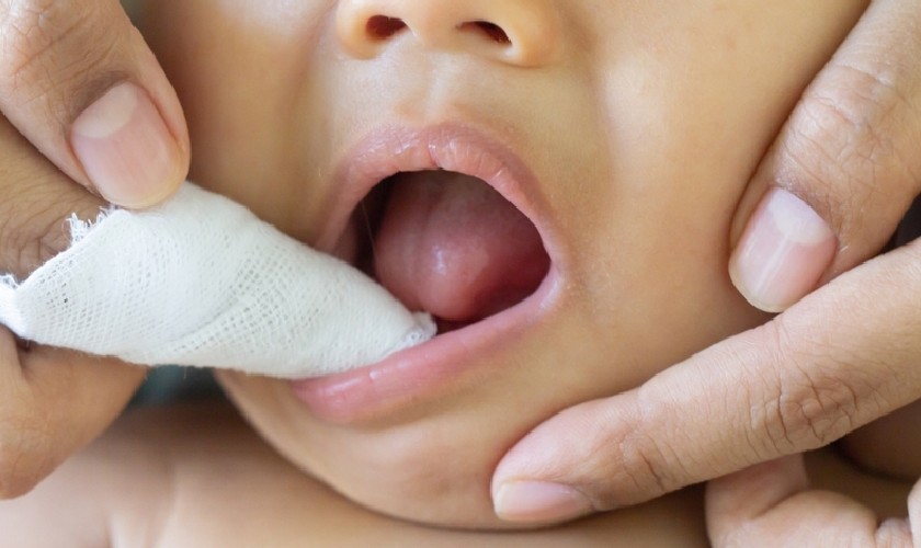 Dung dịch rơ miệng cần phải được làm từ các thành phần tự nhiên, lành tính