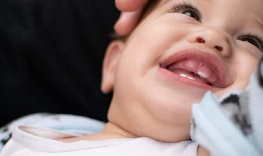 Vùng nướu răng tại vị trí răng chuẩn bị mọc bị sưng lên