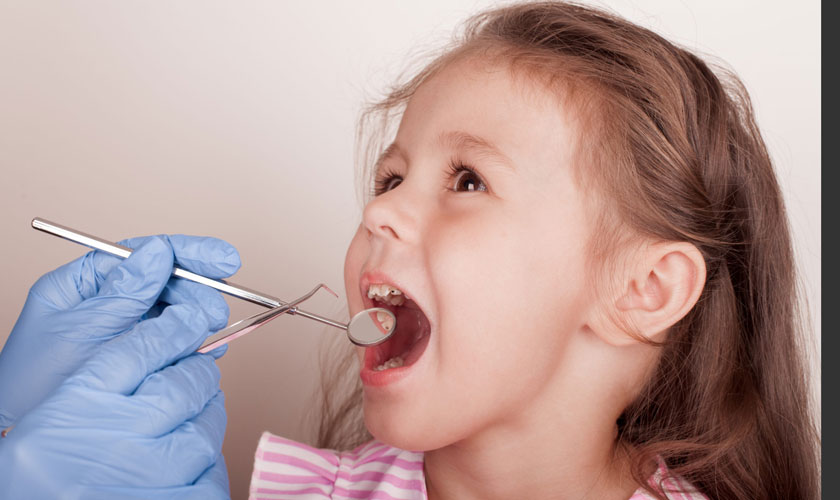 Thăm khám sớm sẽ giúp quá trình điều trị viêm nướu ở trẻ đơn giản hơn Thăm khám sớm sẽ giúp quá trình điều trị viêm nướu ở trẻ đơn giản hơn