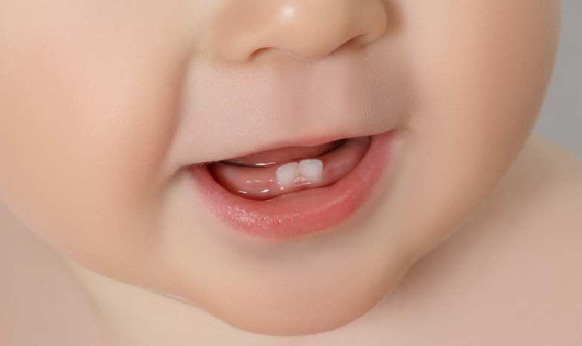 Trẻ thường bắt đầu mọc chiếc răng đầu tiên vào khoảng 6 tháng tuổi