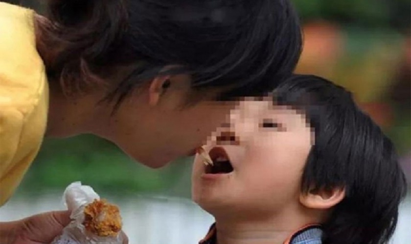 Hành động hôn môi trẻ nhỏ có thể làm lây nhiễm sâu răng