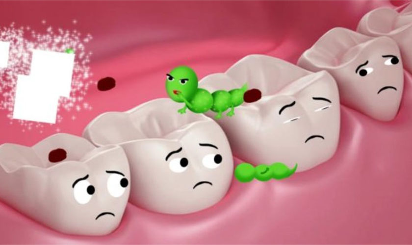 Sâu răng có nguy hiểm tiềm tàng hay không?