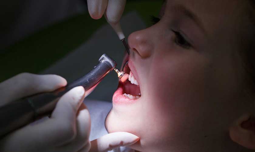 Tùy theo mức độ tổn thương mà sẽ có cách trị xiết ăn răng ở trẻ em thích hợp