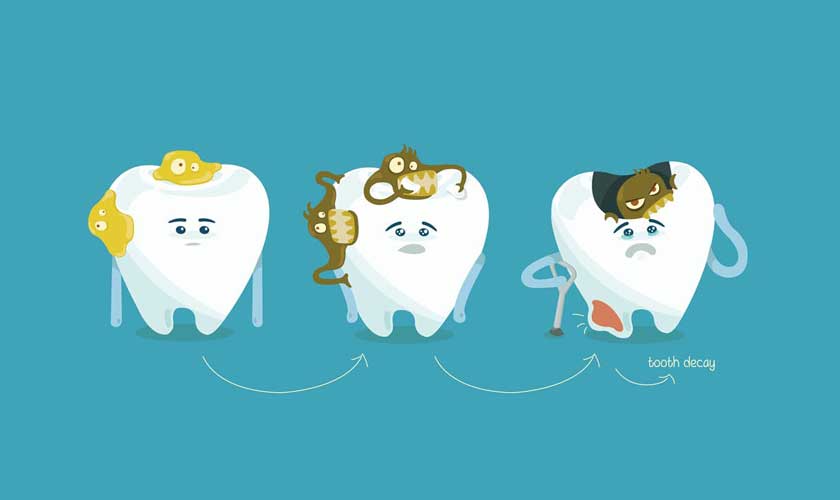 Tùy theo mức độ sâu răng mà sẽ có cách điều trị phù hợp