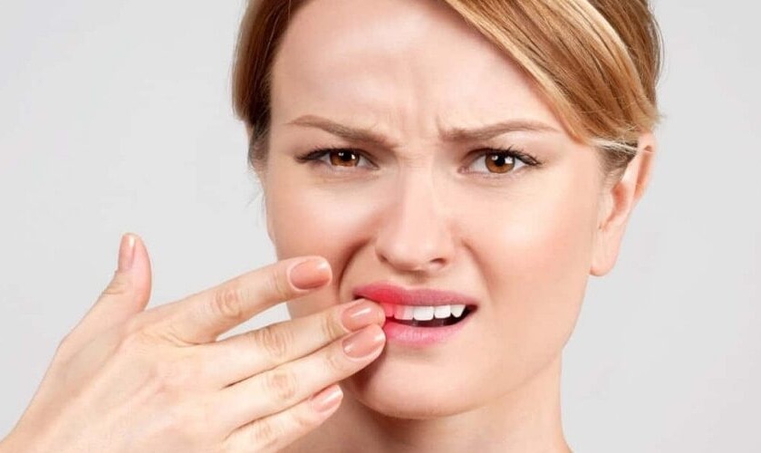 Sâu kẽ răng gây đau nhức, ê buốt răng