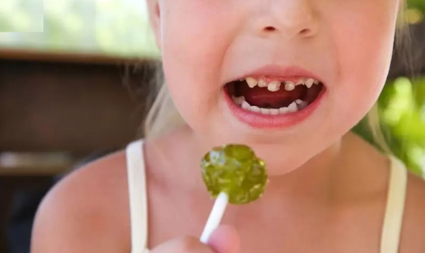 Ăn nhiều kẹo bánh rất dễ gây sâu răng