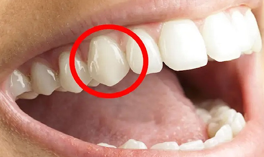 Các răng nanh đảm nhận chức năng năng kẹp và xé thức ăn